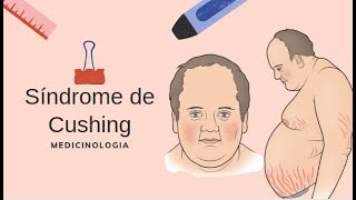 Síndrome de Cushing  Doença de Cushing  Secreção Ectópica de CRH  Adenoma Adrenal [upl. by Novoj]