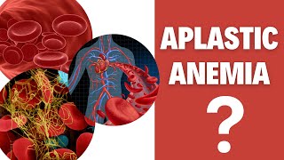 Aplastic anemia Aplastic anemia causes [upl. by Shelagh]