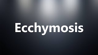 Ecchymosis  Medical Meaning and Pronunciation [upl. by Ainatnas]