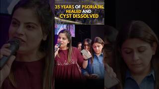 35 years of Psoriasis healed and cyst dissolved [upl. by Elkraps719]