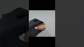 Protezat elastike dentist dentistry smile goviral dentalclinic dentistvisit [upl. by Artimas]