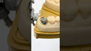 Another Full Cast Gold Molar ⁠EnvisiontecMain envisiontec lsk121shorts dentist teeth [upl. by Nace]