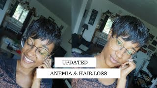 Anemia Hair Loss  Natural Hair Journey Update with Blood Builder Iron Pills and Floradix Iron [upl. by Einberger]