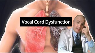 Vocal Cord Dysfunction VCD Paradoxical Vocal Cord Motion [upl. by Gies148]