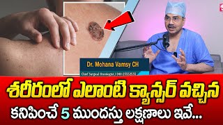 ఒంట్లో కాన్సర్ కణాలు ఉంటె కనిపించే సూచనలు  DrMohan Vamsi About Cancer  Sumantv health [upl. by Andriette]