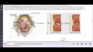 HIT 208 PortaCath Removal External vs Open Approach Explained [upl. by Bethesde38]