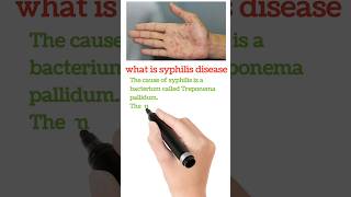 What is syphilis disease calmdown musica amor love skincare nursingmcq humananatomy [upl. by Arras507]