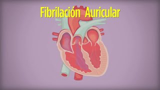 Cómo Vivir con Fibrilación Auricular [upl. by Seuqramed]