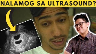 DOCTOR REACTS AkosiDogie AND AprilJoyBarrueso MISCARRIAGE STORY [upl. by Etnohc]