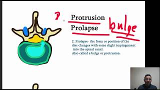 Intervertebral Disk Herniation prolapse  Four Stages of Herniation Made simple [upl. by Ruenhcs]