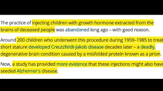 Alzheimers As a Prion Disease [upl. by Jacynth27]