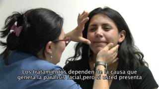 Parálisis Facial [upl. by Kast]