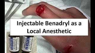 Injectable Benadryl as a Local Anesthetic [upl. by Nnyllatsyrc]