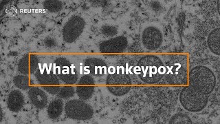 What is monkeypox and how dangerous is it [upl. by Anitneuq]