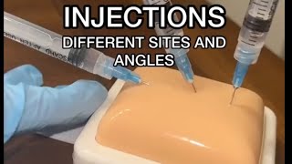 injections different sites and angles  injection doctor medical medicine [upl. by Tibbs]