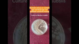 Bacillus subtilis Enterococcus fecalis Desulfovibrio cultures and colonies health microbiology [upl. by Sabah664]