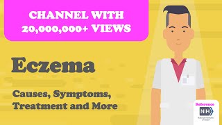 Eczema  Causes Symptoms Treatment and More [upl. by Airelav203]