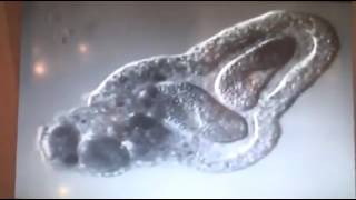 Amoeba eats two paramecia Amoebas lunch [upl. by Quint996]