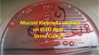 Klebsiella oxytoca on CLED Agar of Urine Sample [upl. by Ardiedal168]