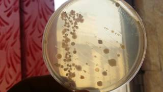 Bacillus subtilis on the nutrient agar [upl. by Cate]