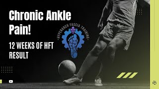 1 Year of Chronic Ankle Pain and Now This  Hyperarch Fascia Training [upl. by Khoury303]