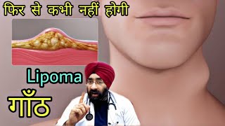 HOW TO STOP LIPOMA REOCCURENCE  गाँठ DREDUCATION HINDI [upl. by Most]