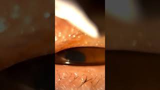 Unblocking oil glands in your eyelid with eyelid massage [upl. by Ttoile]