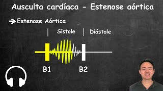 Ausculta cardiaca estenose aortica e insuficiencia aortica [upl. by Jonati548]