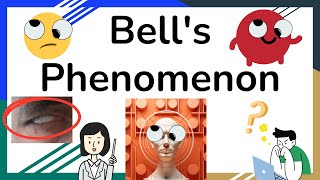 Bells phenomenon  Bell’s reflex  Palpebral oculogyric reflex  Novice Medic [upl. by Sudaorb]