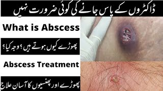 what abscess means abscess treatment in urdu  phora phunsi ka ilaj [upl. by Aicnatsnoc]