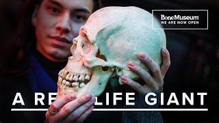 WE HAVE A GIANT Exploring the Rare Condition of Gigantism  The Bone Museum [upl. by Onairelav]