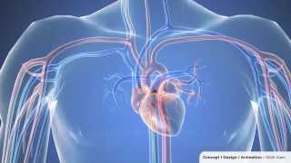 Cardiac catheterization  3D Animation 1080p [upl. by Cecily783]