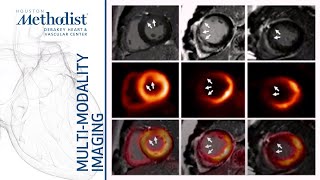 Heart Failure I Evaluating Myocardial Viability Zoghbi MD AlMallah MD Shah MD January 5 2021 [upl. by Elletsyrk307]