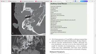 CORE REQUISITES of neuroradiology [upl. by Aiselad460]