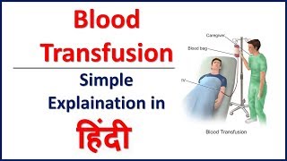 Blood Transfusion simple explaination in Hindi  Bhushan Science [upl. by Nawram21]