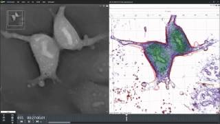 Mitosis of FRCs [upl. by Amadeus]