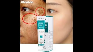 Whitening Freckle Cream Remove Melasma Dark Spot – iBeaLee™ [upl. by Anoynek920]