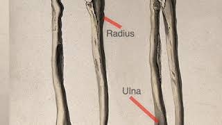 One Minute Anatomy A Difference Between the TibiaFibula amp RadiusUlna [upl. by Akimyt]