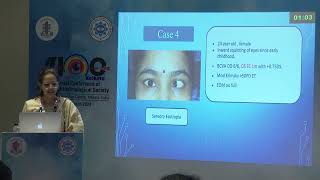 AIOC2024 GP219 Topic Dr Stuti Somani Agarwal Esotropia Surgery how to get it right [upl. by Gonzalez]