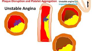 The Pharmacology of The Vasodilators amp The Treatment of Angina Pectoris 1 [upl. by Vargas]