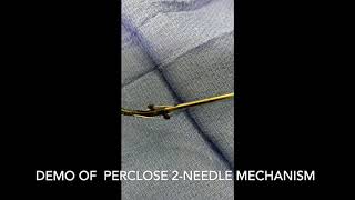 Perclose 2 needle mech [upl. by Hochman]