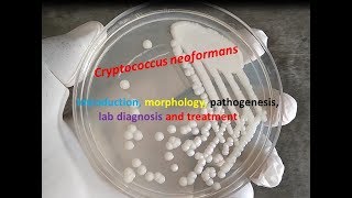 Cryptococcus neoformans Introduction morphology pathogenesis lab diagnosis and treatment [upl. by Ozneral]