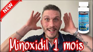 Minoxidil mon évolution la reprise 1 mois je retrouve ma barbe [upl. by Laure]