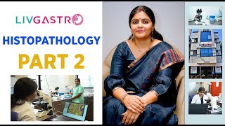 DISCUSSION ON HISTOPATHOLOGY PART 2  SYMPTOMS  TREATMENT  LIFESTYLE  DRANSHITA RAI [upl. by Masson]