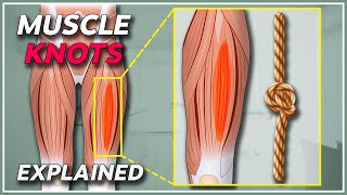 What is a muscle knot  Muscle knots amp trigger points explained [upl. by Crocker]