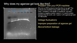 What caused such gel electrophoresis  explained [upl. by Sybilla]