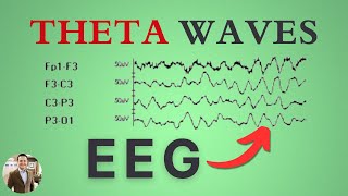 Theta Waves on the EEG [upl. by Yelreveb]