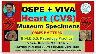 Pathology practical Heart Specimens Dr Sanjay Deshmukh MD Best video Rapid Revision Pathology [upl. by Stroup]