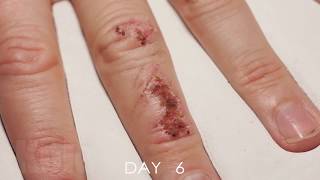 Wound Healing Time Lapse [upl. by Yves363]