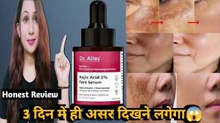 Dr Alies kojic acid 2�ce serum Honest Review  kojic acid 2�ce serum Best use review hindi2024 [upl. by Assirok]